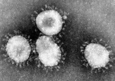 Electron microscopy of a coronavirus