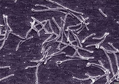 Electron microscopy image of Thermus aquaticus bacteria
