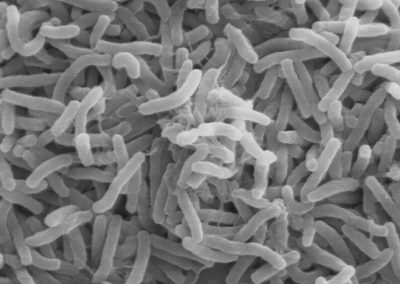 Electron microscopy image of Vibrio cholerae bacteria