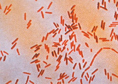 Photomicrograph of Salmonella Typhi bacteria