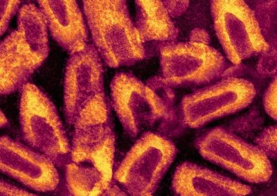 Micrograph of rabies virus