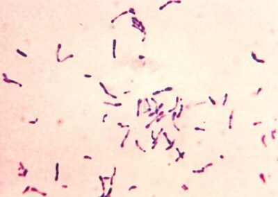 Light microscope image of Corynebacterium diphtheriae, showing rod-shaped bacteria stained in purple against a pale background.