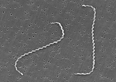 Scanning electron microscope image of Leptospira bacteria, showing their characteristic tightly coiled, spiral-shaped structure.